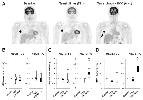 Figure 4. Changes in FDG-PET uptake in patients treated with temsirolimus and HCQ. (A) Serial FDG-PET images in a patient with metastatic melanoma. Arrow: central necrosis. (B–D) Comparison of FDG-PET parameters in patients with no clinical benefit (RECIST measurements > 0) or clinical benefit (RECIST measurement ≤ 0). (B) SUVmax normalized to baseline. (C) Tumor volume normalized to baseline. (D) Partial volume corrected metabolic volumetric product (cMVP); *P < 0.05.