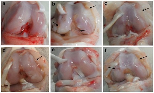 Figure 8 Macroscopic images of the right knee surface of rabbits on day 28. Where a: normal, b: OA, c: OA + 1% Diclofenac-gel, d: OA + 0.5% BTM-MBH, e: OA + 1% BTM-MBH, and f: OA + 1% BTM-EG. The black arrows indicate the damaged areas. Reprintedwith permission from Springer Nature: Drug Deliv Transl res, Topical delivery of 3,5,4′-trimethoxy-trans-stilbene-loaded microemulsion-based hydrogel for the treatment of osteoarthritis in a rabbit model, Hu XB, Kang RR, Tang TT, et al, Copyright 2019.Citation179