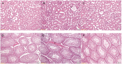 Figure 2. Normal kidney histology in sham group (A). Glomerular necrosis (arrow) in laparoscopy group (B). Improved morphology in CAPE group (C). Normal germinal epithelium in sham group (D). Minimal disorganization and blood (*) in interstitial area in lap group (E). Improved epithelial structure in cape group (F).