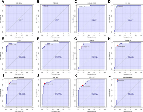 Figure 6 Performance evaluation of differential lipids between NR and CAA groups. (A) PC 35:6e; (B) PC 44:5; (C) Palmitic acid; (D) PC 31:2; (E) PC 37:7; (F) PC 42:9; (G) PC 18:0e; (H) TAG 57:1; (I) Methyl palmitate; (J) LPC 18:0; (K) LPC 17:0; (L) Docosanamide.