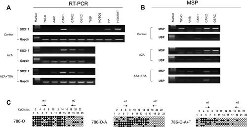 Figure 2 SOX17 is predominantly silenced/downregulated via promoter CpG methylation in RCC. (A) Demethylation treatment with 5-aza-2ʹ deoxycytidine alone or combined with TSA (A+T) restored SOX17 expression in RCC cell lines; GAPDH was used as an internal control. (B) After pharmacologic demethylation, the SOX17 methylation level decreased in methylated RCC cell lines, as demonstrated using MSP. M: methylation, U: unmethylation. (C) BGS analysis of SOX17 promoter region in 786-O cells after demethylation treatment. The filled circles represent methylated CpG sites, and the open circles represent unmethylated CpG sites.