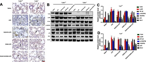 Figure 3 TLR4/NF-κB signaling was involved in the progression of LPS-stimulated ALI. (A) Immunohistochemical staining of CD31 in LPS-stimulated WT and TLR4−/- mice after treatment with DXM and/or SU5416+DXM. (B) Mice were treated with DXM and/or SU5416 for 12 hours, and the expressions of TLR4, p-p65, NF-κB, p-VEGFR2, VEGF2R, p53, Bcl-2, and β-actin in lung tissues were detected with Western blot. (C, D). Relative expressions of TLR4, p-p65, NF-κB, p-VEGFR2, VEGF2R, p53 and Bcl-2. *P<0.01 vs saline; **P<0.05; ***P<0.01 vs LPS.