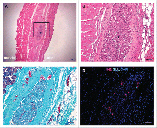 Figure 3. Histological analysis of human islet grafts 24 h post-transplant into the DL site. (A) Hematoxylin and eosin staining of a human islet graft cross-section, transplanted into the subcutaneous DL site; completely cloaked in vascularized tissue scaffold (100x), (B) insert (200x). (C) Mason's trichrome staining of human islet graft within the DL site surrounded by vascularized collagen (blue). (D) Fluorescent staining of the same DL cross-section staining for insulin (red), glucagon (green) and nuclei (blue) (200x). *Indicates human islets within the DL lumen. Scale bar represents 100μm.