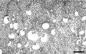 FIG. 2 Kidney photomicrograph. Note that the largest cysts are juxtamedullary. Hematoxylin-eosin. Bar = 800 μm.