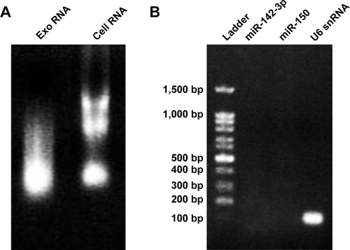 Figure S2 (A) Gel electrophoresis of RNA extracted from MSCs-Exo and their donor cells. (B) The presence of U6 snRNA and the absence of the miR-142-3p and the miR-150 in the RNA content of the MSCs-Exo.Abbreviations: miR, microRNA; derived exosomes.