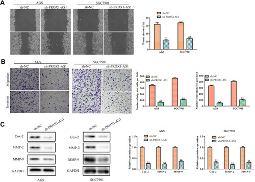 Figure 3 Inhibition of PROX1-AS1 suppresses the migration and invasion of GC cells. (A, B) The wound-healing assay and transwell chamber assays were used to assess cell migration and invasion. (C) The protein expression levels of MMP-2 and MMP-9 in AGS and SGC7901 cells. **P < 0.01 vs sh-NC group.