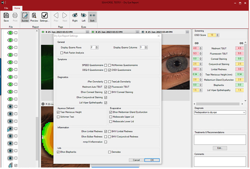 Figure 15 Building a customized dry eye report by reporting the grading scale values of different clinical signs and the results of questionnaires that have been given to the patient. Various exams are available to select and include in the customized report with different grading scale options.