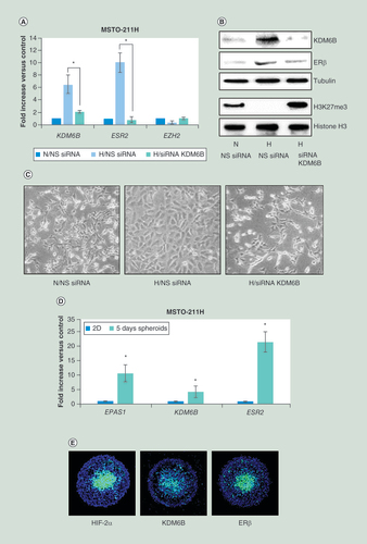 Figure 2.  Expression of KDM6B, ESR2 and EZH2 in MSTO-211H malignant pleural mesothelioma cells grown under chronic hypoxic conditions. (A) Real time-PCR analyses of KDM6B, ESR2 and EZH2 mRNA in MSTO-211H cells transfected with NS siRNA or KDM6B siRNA (siRNA KDM6B) and then incubated for 48 h under N or H conditions. 18S rRNA was used as housekeeping gene. (B) Representative western blot analysis of KDM6B, ERβ, H3K27me3 and total histone H3 in MSTO-211H cells transfected with NS siRNA or KDM6B siRNA (siRNA KDM6B) and then incubated for 48 h under N or H conditions. Tubulin was used as loading control. (C) Phase contrast images (200× magnification) of MSTO-211H cells transfected with NS siRNA or KDM6B siRNA (siRNA KDM6B) and then incubated for 48 h under N or H conditions. (D) Real time-PCR analyses of EPAS1, KDM6B and ESR2 mRNA expressed by MSTO-211H grown for 5 days as spheroids (pools of 5) compared to cells grown in monolayer (2D). 18S rRNA was used as housekeeping gene. (E) Immunofluorescence analysis of HIF-2α, KDM6B and ERβ spatial distribution in MSTO-211H spheroids at day 5, evidenced by fluorescein isothiocyanate-conjugated secondary Abs.Each graph is representative of three independent experiments. Each bar represents mean ± standard deviation.*p ≤ 0.05.ERβ: Estrogen receptor β; H: Hypoxic; N: Normoxic; NS: Nonspecific control siRNA.