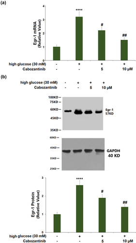 Figure 6. Cabozantinib reduced the expression of Egr-1 against high glucose in hGECs. (a). mRNA of Egr-1; (b). Protein of Egr-1 (****, P < 0.0001 vs. Vehicle group; #, ##, P < 0.05, 0.01 vs. high glucose group).