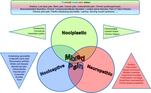 Figure 1. The three different types of pain defined by the IASP give rise to overlap which can be acknowledged as “mixed pain” (Freynhagen©). Conditions described as “mixed pain” in the literature share a common characterization of manifesting clinically with a substantial overlap of the different known pain types.