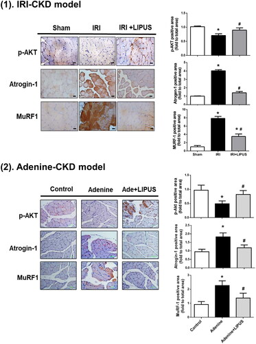 Figure 3. Effects of LIPUS on the immunointensity for phosphorylated Akt, Atrogin-1, and MuRF1 in soleus muscles of CKD mouse models. Two mouse models of unilateral IRI with contralateral nephrectomy (1) and adenine administration (2) were used. Immunohistochemistry for the protein expression of phosphorylated Akt, Atrogin-1, and MuRF1 was shown. The relative optical density of immunohistochemical images in five random visual fields of each section was determined by the image J 1.48 software. Data are presented as mean ± SEM (n = 8 for IRI model; n = 9 for adenine model). *p < 0.05 versus sham group; #p < 0.05 versus CKD alone group.