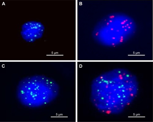 Figure 1 Fluorescence microscopy images of three types of CTCs isolated from the peripheral blood osteosarcoma patients, based on RNA-ISH staining of epithelial (red dots) and mesenchymal (green dots) markers.