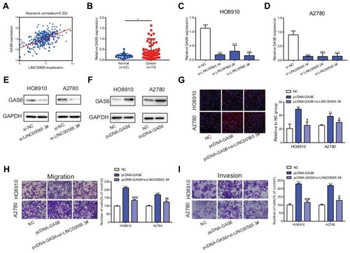 Figure 4 LINC00565 and GAS6 play a synergistic role in promoting cancer. (A) LINC00565 was positively correlated with GAS6 analyzed by TCGA. (B) qRT-PCR verified that GAS6 was highly expressed in 74 OC samples compared to 22 normal ovarian tissues. (C–D) The mRNA expression of GAS6 was reduced after HO8910 and A2780 cells transfected with si-LINC00565. (E) The protein expression of GAS6 was reduced after HO8910 and A2780 cells transfected with si-LINC00565. (F) After transfecting with plasmid, GAS6 protein expression was increased distinctly. (G–I) Overexpression of GAS6 in HO8910 and A2780 cells markedly facilitated proliferation, migration and invasion, but was further reversed by LINC00565 knockdown. *P<0.05; **P < 0.01; ***P < 0.001. #P<0.05; ##P < 0.01; ###P < 0.001.