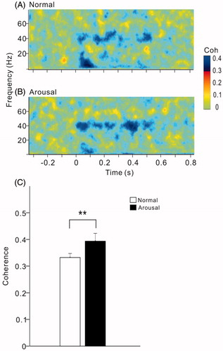 Figure 8. Spectral-temporal function of coherence between A1 and mPFC under normal (A) and arousal condition (B). The same example shown in Figure 1. Note an enhancement of coherence at 40-Hz under arousal condition. (C) Bar graph showing the mean and SE of 40-Hz coherence in all the rats under different conditions. **Indicates p < .01, paired t-test.