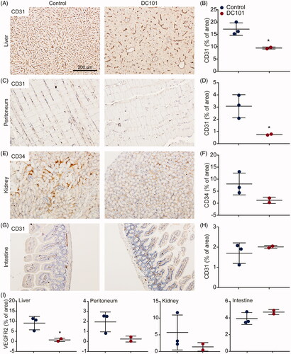 Figure 3. DC101 therapy has systemic off-target effects by reducing vascularization in intraperitoneal organs. Nude mice were treated with 40 mg/kg DC101 or PBS control therapy twice a week for four weeks and changes in vascularization were detected using CD31 or CD34 immunohistochemical stainings on (A) liver, (C) peritoneum, (E) kidney, and (G) intestine tissue sections. CD31 and CD34 stainings in (B) liver, (D) peritoneum, (F) kidney, and (H) intestine were quantified using ImageJ software as percentage of area. (I) Tissue sections of intraperitoneal organs were immunohistochemically stained for VEGFR2 and quantified using ImageJ software as percentage of area. Scatter dot plots show the mean ± SD, n = 3 per group. *p < .05 were determined by two-sided unpaired t-tests and analyzed against untreated control.