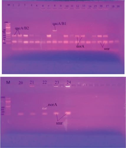 Figure 3. Agarose gel electrophoresis of the Multiplex PCR for the qacA/B1, qacA/B2, smr and norA genes for 24 CHG resistant MRSA strains. M is the ladder DNA.