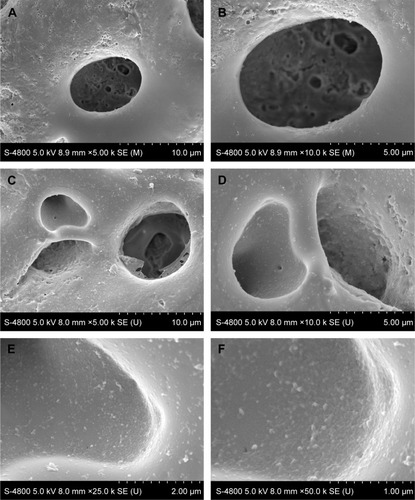 Figure 2 Morphology of the MAO Ti surfaces before and after HA/CS/miR-21 nanoparticle coating.Notes: The morphology was assessed by SEM. (A and B) Different-magnification images of the naked MAO surface. (C–F) Images of the HA/CS/miR-21 nanoparticle-functionalized MAO surface at increasing magnification.Abbreviations: CS, chitosan; HA, hyaluronic acid; SEM, scanning electron microscopy; MAO, microarc oxidation; miR-21, microRNA-21; Ti, titanium.