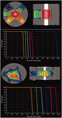 Figure 1. Top two rows: Dose color wash showing dose distribution for the static plan on the Gammex phantom in the HN setup, with the six different density inserts and the corresponding DVHs for the six artificial volumes. Two bottom rows: The volumetric modulated 2-arc plan on the Gammex phantom in the pelvis setup, with the six different density inserts and the corresponding DVHs for the six artificial volumes. The artificial tissue equivalent inserts represent: dense lung (green – at 1:30 o’clock), dense bone (red – 4:30), bone (magenta – 7:30), solid water (cyan – 9:00), lung (orange – 10:30), and CaCo3 (blue – center). The dose color wash levels are set at 90% of the mean dose of the inserts.