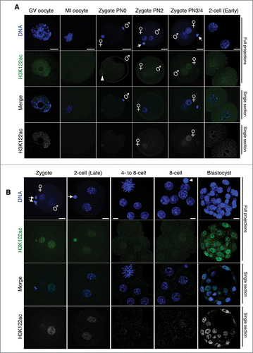 Figure 2. H3K122ac is present at low levels in cleavage stage embryos. (A) H3K122ac was analyzed in oocytes and zygotes immediately after fertilization, freshly collected from natural matings. The top 2 panels show maximal projections of confocal Z-sections for H3K122ac (green) or DAPI (blue) of representative embryos of at least 16 analyzed per stage. The bottom panel shows a middle confocal section where the gray and blue channels are merged. When present, the polar body is indicated by an arrowhead. The male and female pronuclei are indicated. Scale bar is 12 μm. (B) Embryos at the indicated stages were freshly collected, fixed, stained with an H3K122ac (green) antibody, and analyzed using confocal microscopy. DNA is shown in blue. Shown are full projections of Z-sections taken every 1 μm (cleavage) or 2 μm (blastocyst). The bottom panel is the same channel for the merge shown on the third row, but showing the H3K122ac channel in gray scale. When present, the polar body is indicated by an arrowhead. The male and female pronuclei are indicated. At least 10 embryos from independent experiments were analyzed per stage. Embryos shown were imaged under identical conditions, thus fluorescence levels are directly comparable. Scale bar is 12 μm.