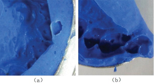 Figure 15. (a) Tooth marks are covered. (b) Inclined tooth marks caused by incorrect bite.