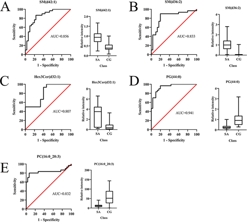 Figure 5 ROC curves and boxplots for the top 5 differential lipids of highest diagnostic value. (A): SM (d42:1); (B): SM (d36:2); (C): Hex3Cer (d32:1); (D): PG (44:0); (E): PC (16:0_20:3).