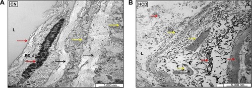 Figure 29 Ultrastructural electron micrographs of aortic endothelial cells (ECs) in CN (A) and HCD (B) groups.