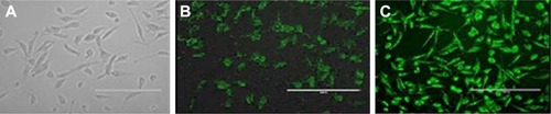 Figure 9 Cellular uptake and intracellular localization of DOX and DOX–GCPQ nanoformulations in human RD cells observed by fluorescence microscopy of (A) untreated cells, (B) fluorescence of internalized DOX inside RD cells, and (C) fluorescence of internalized DOX–GCPQ inside RD cells.Note: Magnification 40×.Abbreviations: DOX, doxorubicin; GCPQ, quaternary ammonium palmitoyl glycol chitosan; RD, rhabdomyosarcoma.