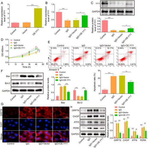 Figure 2. YY1 overexpression alleviated LN-IgG-induced ERS and apoptosis in podocytes. (A) YY1 expression in MPC5 cells after vector or OE-YY1 transfection was examined by qRT-PCR. MPC5 cells were treated with serum IgG from LN patients (LN-IgG) and YY1 overexpression was induced. (B-C) YY1 level in cells was determined using qRT-PCR and western blot. (D) CCK8 assay was performed to determine cell viability. (E) Cell apoptosis was analyzed by flow cytometry. (F) Bax and Bcl-2 protein levels were measured by western blot. (G) Immunofluorescence was employed to analyze GRP78 level in cells. (H) GRP78, CHOP, ATF6 and PERK protein levels in cells were assessed using western blot. Data were expressed as mean ± SD. All our data were obtained from three independent experiments. *p < 0.05, **p < 0.01, ***p < 0.001.