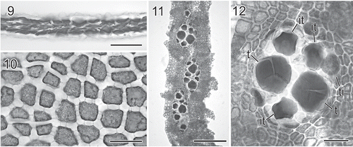 Figs 3. Martensia leeii W.-C. Yang & S.-M. Lin sp. nov. Vegetative morphology and tetrasporangial formation (Lung Dong Wan, New Taipei City). 9. Cross-section through basal part of a membranous blade. Scale bar = 100 μm. 10. Close-up of surface cells showing discoid plastids and numerous secondary pit-connections. Scale bar = 50 μm. 11. Close-up of tetrasporangial sori borne on a longitudinal lamella. Scale bar = 250 μm. 12. Close-up of a tetrasporangial sorus showing multinucleate tetrasporangial initials (ti), immature tetrasporagia (it) and tetrahedrally divided tetrasporangia (t). Scale bar = 50 μm.
