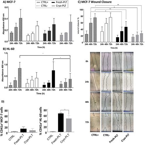 Figure 5. Effect of PLT supernatants on cancer cells behavior in vitro. Cell proliferation profile of (a) MCF-7 and (b) HL-60 cell lines conditioned with the Fresh- and Cryo-PLT supernatants evaluated by WST1 assay after 24, 48 and 72 h of seeding. (c) analysis of MCF-7 cells migration by in vitro wound healing assay. Quantification of the wounded area invaded by MCF-7 and time-lapse representative microscopy images of MCF-7 cells after 24, 48 and 72 h of conditioning with PLT supernatants. Data are reported as percentage (%) of wound closure at the baseline (T = 0 h after treatment). Results are reported as mean ± SD of three measurements of the wounded area, obtained in 5 independent experiments (n = 15). The dotted lines define the area lacking cells. Scale bars, 100 μm. (d) PLT- cancer cells adhesion. Percentage of CD41a-positive cells (MCF-7 or HL-60) after being conditioned with Fresh- or Cryo- PLT supernatant. Control (CTRL) are same cells w/o any conditioning. Data are reported as mean ± SD of three independent experiments. Statistical analysis was performed using one-way ANOVA with multiple comparisons *p < .01, **p < .005.