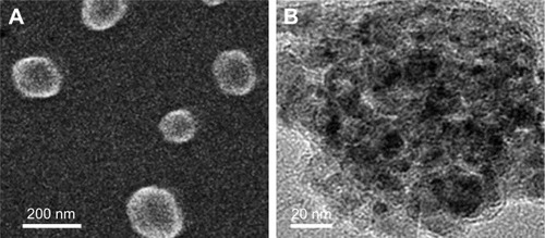 Figure 2 Morphology of THNCs.Note: (A) SEM and (B) TEM images of THNCs.Abbreviations: SEM, scanning electron microscopy; TEM, transmission electron microscopy; THNCs, Trojan Horse nanocarriers.