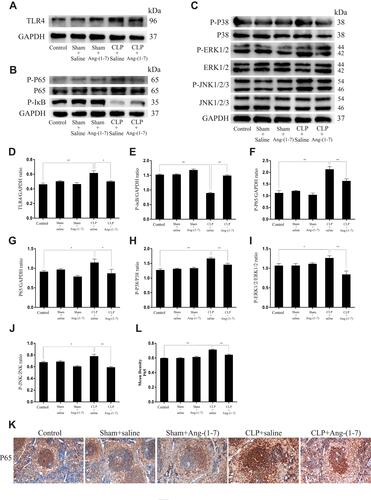 Figure 6 Ang-(1–7) inhibited TLR4-mediated NF-κB and MAPK in spleens of CLP-induced models. (A–C) Representative Western immunoblots for TLR4, P65, P-P65, P-IκB, P38, P-P38, ERK1/2, P-ERK1/2, JNK, and P-JNK. (D–J) Bar graph showing the corresponding quantitative data. (K) Representative immunohistochemistry tissue staining images of frozen spleen slices were measured for the nuclear translocation of NF-κB p65 (scale bar: 200 μm). (L) The mean density of immunohistochemistry images were presented. Error bars indicated the mean ± SD for three separate experiments, n = 3 for each group, *p < 0.05; **p < 0.01.