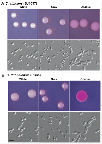 Figure 1. White-gray-opaque transitions in C. albicans (BJ1097, A) and C. dubliniensis (PC35, B). Homogeneous white, gray, or opaque cells were plated on agar plates. Colony and cellular morphologies of the 3 different phenotypes (white, gray, and opaque) are shown. The colonies and cells were imaged after 5 d of growth at 25°C in 5% CO2. Scale bar, 10 μm. Phloxine B (a red dye that stains gray colonies light pink and opaque colonies red) was added at a concentration of 5 μg/mL to Lee's GlcNAc medium.