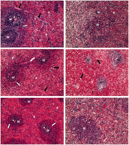 Figure 3. Photomicrographs of splenic parenchyma of different sections (H&E; 100×). Normal control rat section (top left) shows lymphatic follicles (W) named white pulp surrounded with red pulp (R). Lymphatic follicles show central arteriole (arrowhead) and well-defined marginal zone (white arrow). Trabeculae can be observed (black arrow). Arthritis control rat section (top right) shows atrophy of white pulp (W) and red pulp (R). Dexamethasone-treated arthritic rat section (middle left) shows lymphatic follicles (W) named white pulp surrounded with red pulp (R). Lymphatic follicles show central arteriole (arrowhead) and well-defined marginal zone (white arrow). Trabeculae can be observed (black arrow). Methotrexate-treated arthritic rat section (middle right) shows slight atrophy of white pulp (W) with the appearance of many foamy cells (black arrow) within red pulp (R). Fenofibrate-treated arthritic rat section (bottom left) shows lymphatic follicles (W) named white pulp surrounded with red pulp (R). Lymphatic follicles show central arteriole (arrowhead) and well-defined marginal zone (white arrow). Resveratrol-treated arthritic rat section (bottom right) shows normal white pulp (W) and atrophic red pulp (R).