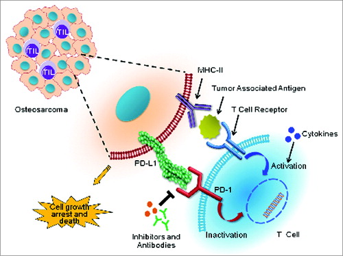 Figure 1. Immunotherapeutic targeting of PD-1 and PDL1 reciprocal interactions between osteosarcoma cells and T cells. Binding of the T-cell inhibitory receptor programmed cell death 1 (PD-1) to its cognate ligand PDL1 on the surface of cancer cells inactivates T-cell cytotoxic functions that otherwise would induce osteosarcoma cell death. Abrogating this pathway with anti-PD-1 or PDL1 blocking antibodies (or inhibitors) prevents this inhibition, and allows the reactivation of T-cell anticancer cytotoxic functions. Adding immune activators, such as cytokines, may elicit a synergistic response to anti-PD-1/PDL1 targeted therapies in osteosarcoma.