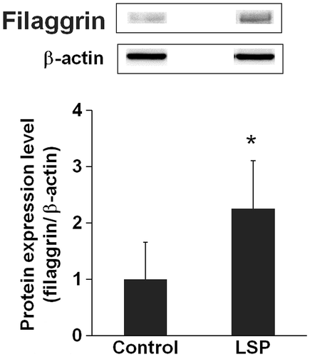 Fig. 2. Effects of LSP on Filaggrin Protein Expression Level in Normal Human Keratinocytes.Note: NHEK were incubated with 0.1 μg/mL of LSP or medium (vehicle) and the gene expression levels for filaggrin protein expression were measured by Western blotting on the ninth day. The results of relative quantification where protein expression levels with no SP of ninth day (control on the ninth day) are “1.” Values are means ± SD of three experiments. *p < 0.05: compared to the control on the ninth day, Student’s t-test.