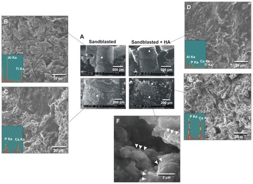 Figure 7 Morphological and elemental analyses of the sandblasted and sandblasted + hydroxyapatite-coated implant interfaces at early healing stage of week two. The implants were retrieved after push-in test and the tissue interfaces were exposed and analyzed by scanning electron microscopy and energy dispersive X-ray. (A) Representative low-magnification scanning electron microscopic images of the retrieved implants. (B and C) High-magnification scanning electron microscopic images and energy dispersive X-ray spectra of the sandblasted surfaces for the areas indicated in (A). (D–F) High-magnification scanning electron microscopic images and energy dispersive X-ray spectrum of the sandblasted + hydroxyapatite-coated implant surfaces for the areas indicated in (A).Abbreviations: Al, aluminum; Ca, calcium; HA, hydroxyapatite; P, phosphorus; Ti, titanium.