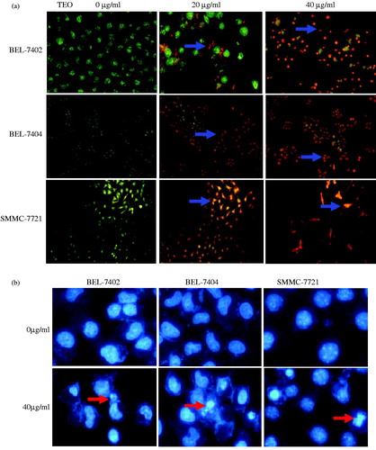 Figure 4. (a) Representative images of AO/EB stained BEL-7402 cells (200×, final magnification), BEL-7404 cells and SMMC-7721 cells (100×, final magnification). After TEO treatment, apoptotic cells (orange fluorescence) exhibited chromatin condensation and apoptotic bodies (arrows). (b) Representative images of DAPI stained three HCC cell lines (200×, final magnification). Arrows indicate nuclear condensation or fragmentation.