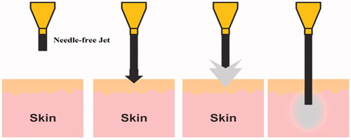 Figure 10. Mechanism of needle-free jet injection system.