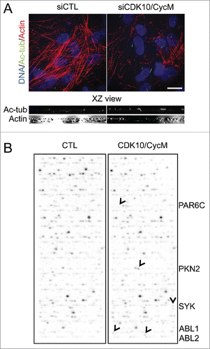 Figure 2. CDK10/CycM maintains actin network architecture and phosphorylates actin dynamics regulators (A) Immunofluorescent visualization of primary cilia (acetylated-tubulin staining, shown in green) and F-actin (Rhodamine-Phalloidin staining, shown in red) without (siCTL) or with CDK10 or CycM silencing under the same conditions as Figure 1. DNA was stained with DAPI (shown in blue). Scale bar, 25 μm. The XZ view shows XZ optical projections of the cilia structure and actin structure (taken from a horizontal middle cross section) in a baso-apical manner. (B) In vitro kinase assay on protein arrays without kinase (CTL) or with recombinant purified CDK10/CycM. Positive hits (differential signals between both arrays) are indicated with black arrows and listed on the right.