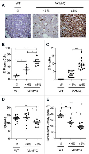 Figure 2. Both M-spike and BM plasma cells increase during disease progression in Vk*MYC mice. (A) Paraffin-embedded sections of the shinbone from Vk*MYC and sex-and age-matched WT littermates were analyzed by immunohistochemistry after staining with anti-IRF-4 mAb (40x magnification). (B) The number of BM plasma cells was also quantified in blind by an expert pathologist. (C) Mice were also assessed for percentage of serum M-spike by serum protein electrophoresis analyses. (D) Hemoglobin (Hgb) concentration, and (E) bone mineral density were assessed individually in the indicated groups of mice as described in the Materials and Methods section. Each dot represents an individual mouse. Data are reported as mean ± SE. Statistical analyses (Student's t test): *p < 0.05; **p < 0.01; ***p < 0.001.