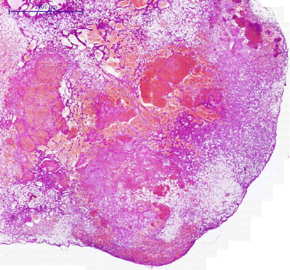 Figure 1. Histopathological picture of the budgerigar angiolipoleiomyoma with classical triads—haemangioma, smooth muscle bundles, and mature white adipose tissues—at low magnification. Haematoxylin and eosin. Bar: 2000 µm.