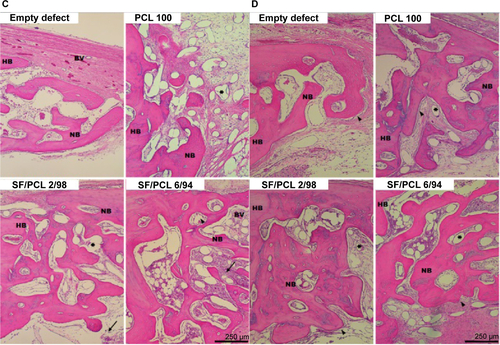 Figure S3 Hematoxylin and eosin-stained histological sections after implantation at high magnification.Notes: Representative histological sections show cross sections of calvarial defects with native bone at the edge; (A) 1 week, (B) 2 weeks, (C) 4 weeks, and (D) 8 weeks. Note the presence of blood clots (empty arrows), inflammatory cells (thin black arrows), osteoblasts (arrowheads), and remaining scaffolds (asterisks). Scale bar 250 μm. Original magnification 100×.Abbreviations: PCL, poly(ε-caprolactone); SF, silk fibroin; HB, host bone; NB, new bone; BV, blood vessel; CT, connective tissue.
