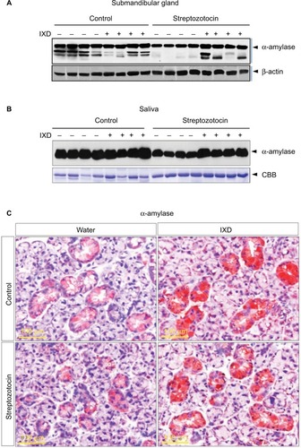 Figure 4 α-amylase protein expression was increased in IXD-treated diabetic rats