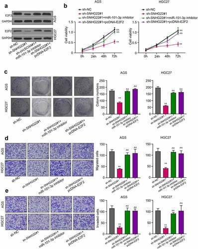 Figure 5. SNHG22 regulates gastric cancer cell progression via the miR-101-3p/e2f2 axis. (a) Western blot analysis was performed the protein expression of E2F2 in gastric cancer cell lines after transfection. (b) CCK-8 assay was utilized to detect the cell viability after transfection. (c) Colony formation assay was performed the proliferation of gastric cancer cell lines transfected with miR-101-3p inhibitor or E2F2 overexpression. (d) and (e) Gastric cancer cell line migration and invasion ability were evaluated by Transwell assay. Data are presented as the mean ± SD of at least three independent experiments. The significance level is defined as P <0.05. (**P <0.01 vs sh-NC; ^^P <0.01 vs sh-SNHG22#1).