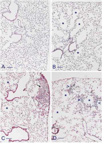 Figure 1. Photomicrographs of lung sections stained with Masson’s trichrome form smoking ICR, C57 Bl/6 and DBA/2 mice at 7 months from the start of experiments. ICR mice display a well-fixed parenchyma with a normal architecture (A). C57 Bl/6 mice show multiple areas of emphysema (*) scattered throughout the parenchyma (B). In DBA/2 mice emphysematous changes (*) are present together with evident fibrotic lesions located mainly in subpleural areas (C, arrow) and some intraparenchymal fibroproliferative changes characterized by infiltration of inflammatory cells and deposition of extracellular matrix (“sea green areas”) (D, arrowheads). Scale bars = 100 µm.