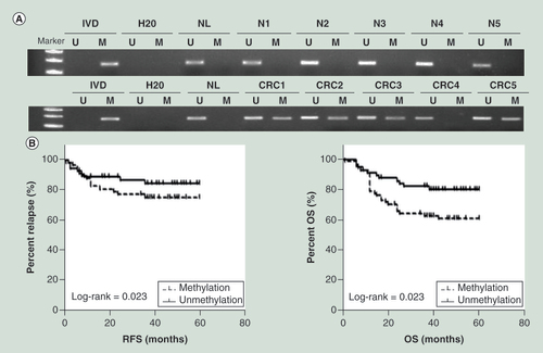 Figure 2. SLFN11 is frequently methylated in human primary colorectal cancer tissues and the role of SLFN11 in overall survival and relapse-free survival in colorectal cancer patients. (A) Representative MSP results of SLFN11 in normal colorectal tissues (N1, N2, N3, N4 and N5) and primary CRC tissues. (B)SLFN11 methylation status is associated with RFS and OS of CRC patients.CRC: Colorectal cancer; OS: Overall survival; RFS: Relapse-free survival.