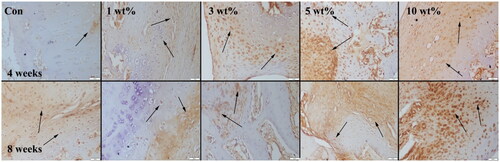 Figure 7. BMP-2 expressions (indicated by arrows) at 4 weeks (upper row) and 8 weeks (below row) groups. Streptavidin biotin peroidase method, scale bar = 50 µm.