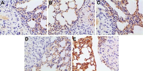 Figure 13 Immunohistochemical staining for IL-8 of orthotopic tumors in all the groups.Notes: (A) Positive group, (B) combination group, (C) test group, (D) reference group, and (E) model group. Magnification ×400.Abbreviation: IL, interleukin.