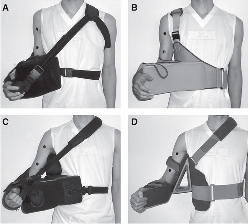 Figure 1. Shoulder braces. A: The UltraSling ER with a 15° wedge. B: The Shoulder Brace ER. C: The SmartSling with an axilla pillow. D: The Omo Immobil with shoulder-positioning at 30° abduction and 30° external rotation. A and B are the ER braces, and C and D are the A-ER braces.
